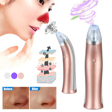 Load image into Gallery viewer, SkinClean™ Deluxe Rechargeable Blackhead Remover Vacuum - Facial Pore Cleaner
