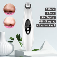 Load image into Gallery viewer, SkinClean™ Rechargeable Blackhead Remover Vacuum - Facial Pore Cleaner with 3 Probes
